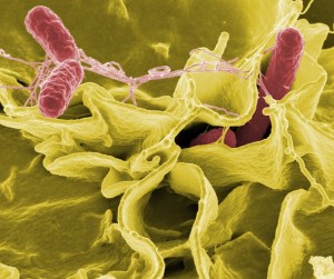 Laktobacily aneb hodné bakterie ve vašich střevech